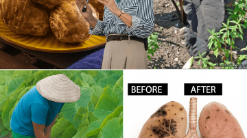 11 Natural Beauty Hacks Using Banana, Tomato, and Toothpaste (That Actually Work Safely!)