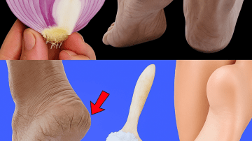 11 Natural Beauty Hacks Using Banana, Tomato, and Toothpaste (That Actually Work Safely!)