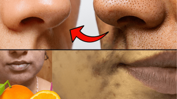 🌿 The Weed That Whispers Secrets to Your Kidneys: Unlock Goosegrass’s Hidden Power