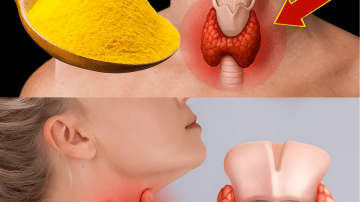 I Almost Lost My Kidneys – Until This 3-Ingredient Elixir Saved Me